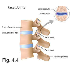 facet joints and back pain