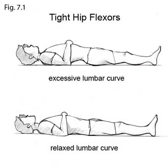 Hip Flexor Tightness and Why It Is Killing Your Low Back - Amity Physical  Therapy