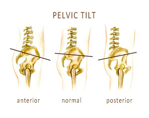 Pelvic Tilt and Lower Back Pain